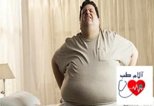 انواع کمردرد ناشی از چاقی