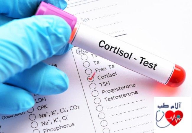 علامت اختصاری کورتیزول در آزمایش خون