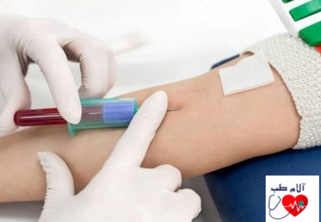 خدمات آزمایش خون در منزل شامل چه مواری است؟