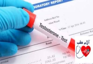 آزمایش هورمون تستوسترون چیست